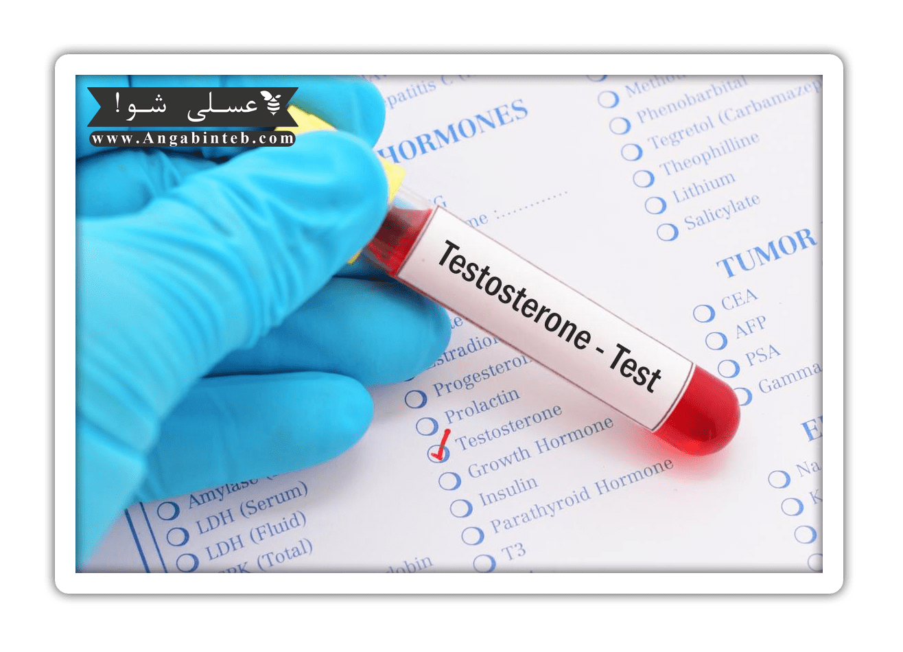 Sexual disorders-testestrone-min